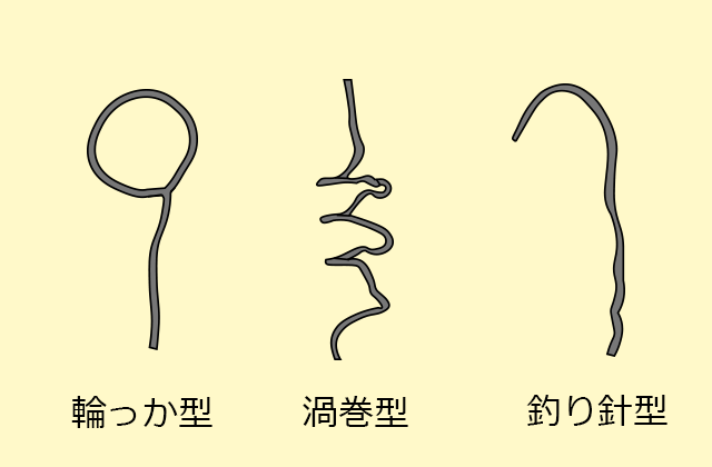 針金ハンガーを代用するときの変形型